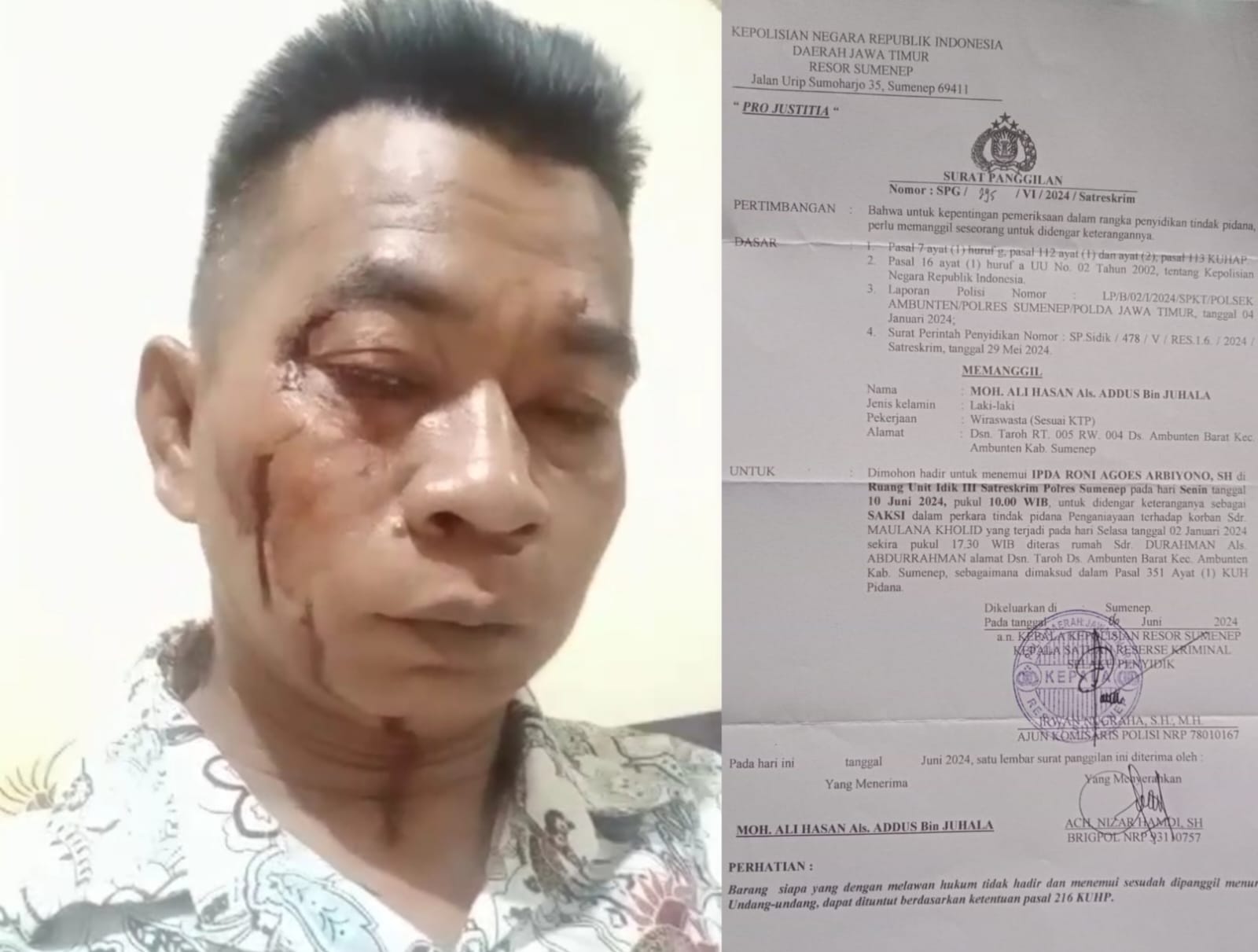 Terlapor Buat Laporan Balik Diduga Atas Settingan dan Rekayasa Polres Sumenep Pada Kasus Pengeroyokan Wartawan