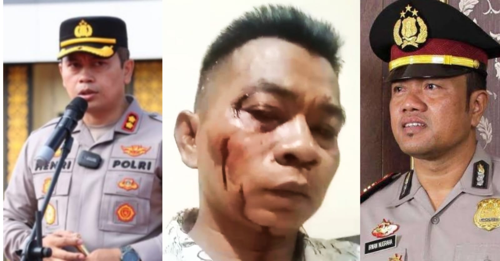Miris, Hampir Mati Dikeroyok, Wartawan Sumenep Malah Dijadikan Tersangka Penganiayaan