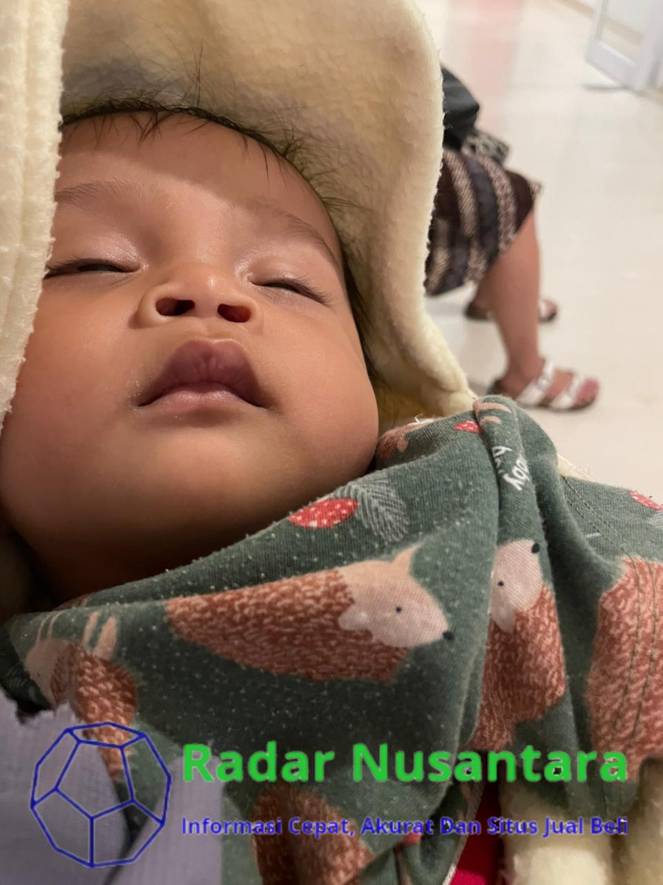 Terkait Dugaan Malpraktek, Kuasa Hukum Yessi Irmadani Ajukan Perlindungan Hukum