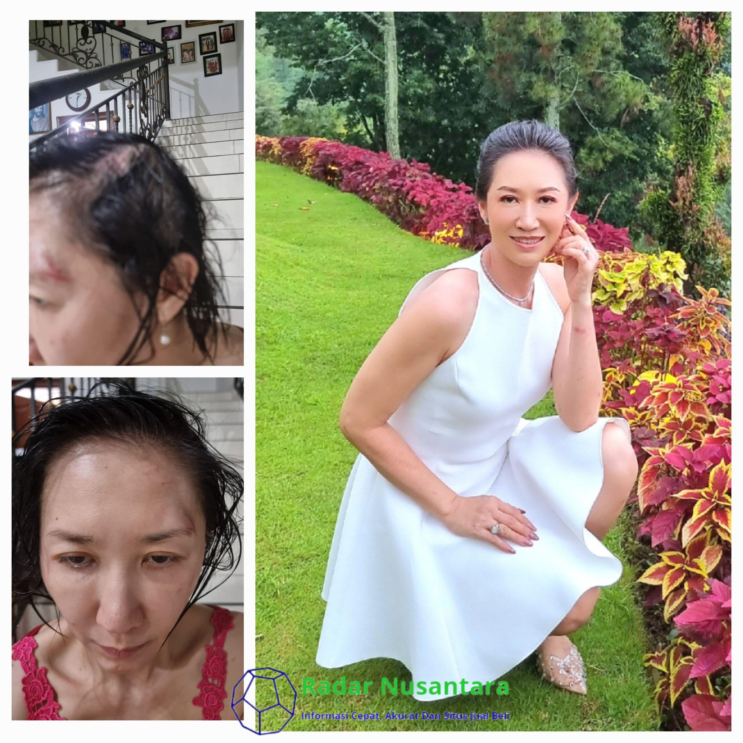 Sherly Chebing Bangkit dari Trauma, Menjadi Suara bagi Korban Kekerasan