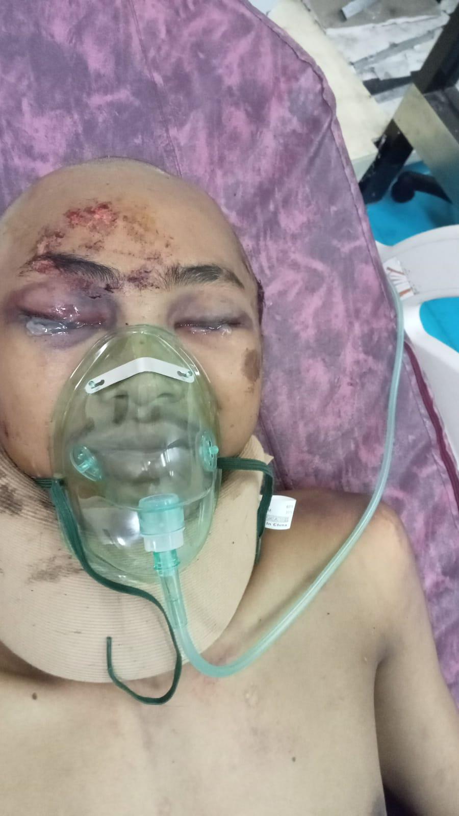 Jasa Raharja Lambat, Keluarga Korban Laka Lantas Garut Terima Kesulitan